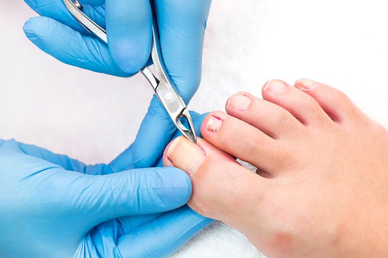About Expert Footcare