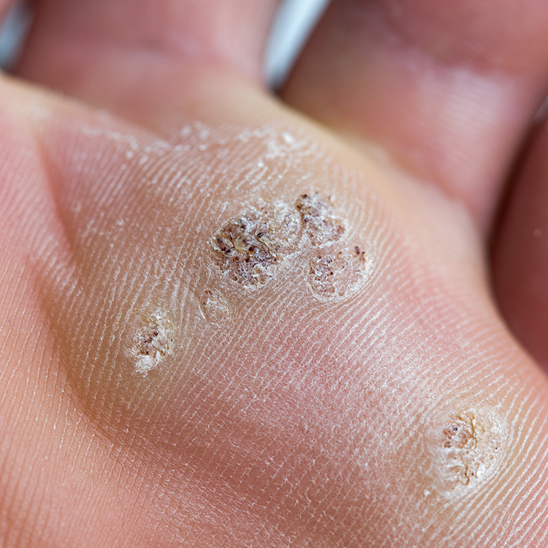 General Podiatry & Chiropody