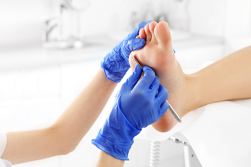 Expert Footcare - Our Footcare Services - Thatcham & Hungerford